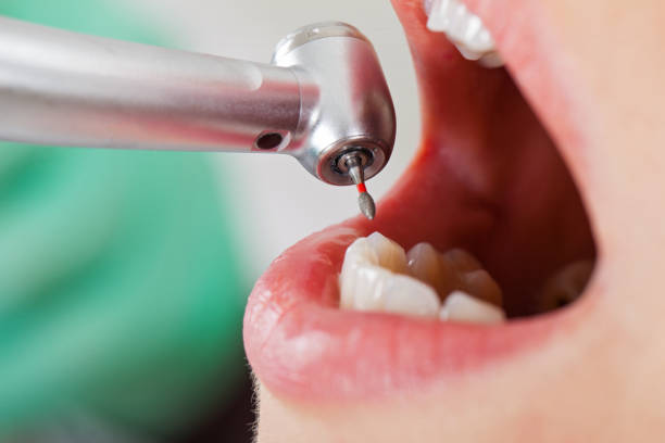 Best Emergency Dental Care for Sports Injuries in Allentown, NJ